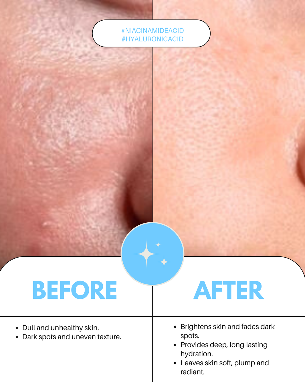 Freshtone & Hydration Ampoule