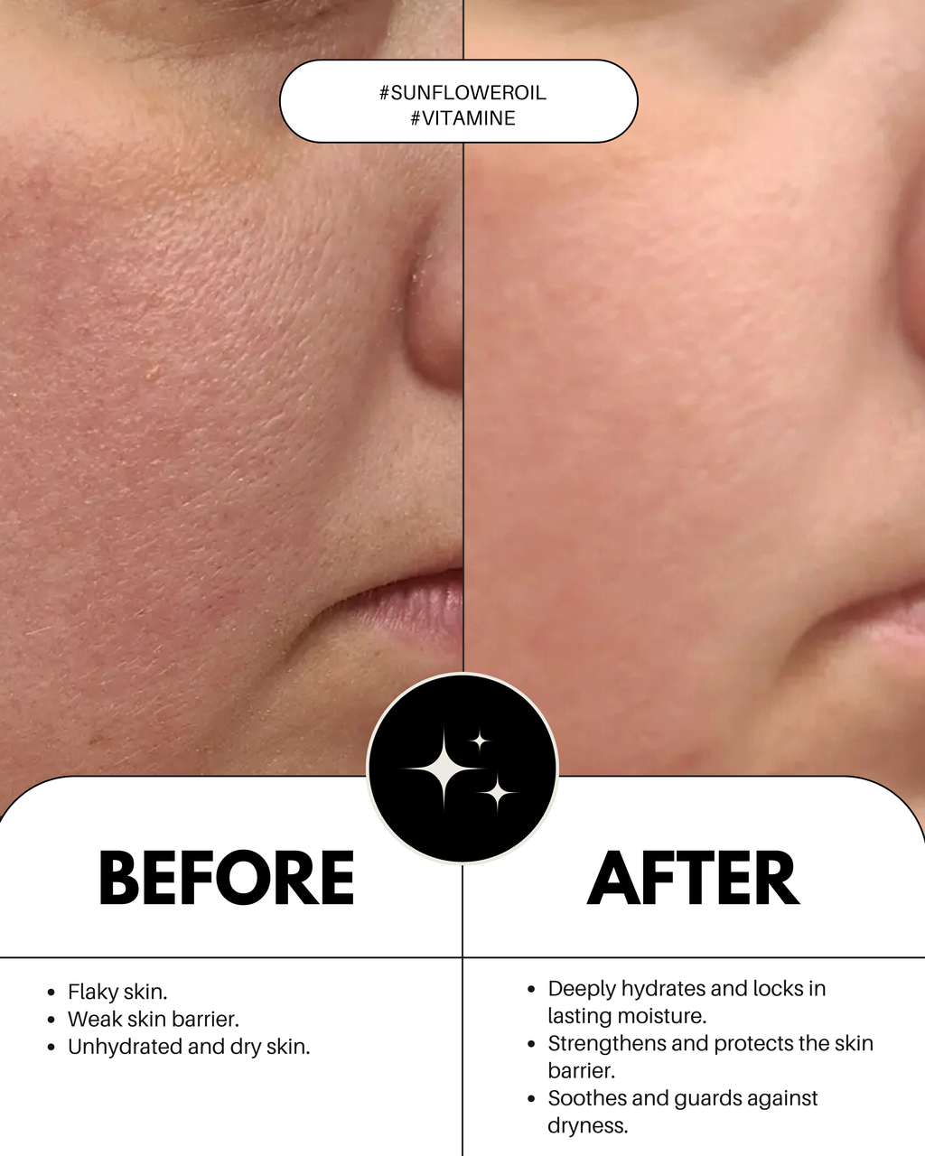 Milk Skin Moisturizer