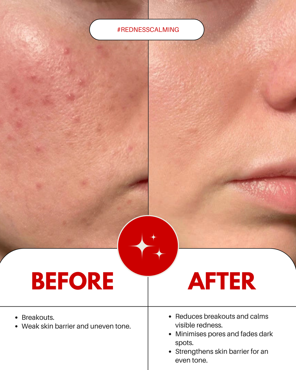 Redness Soothing Serum