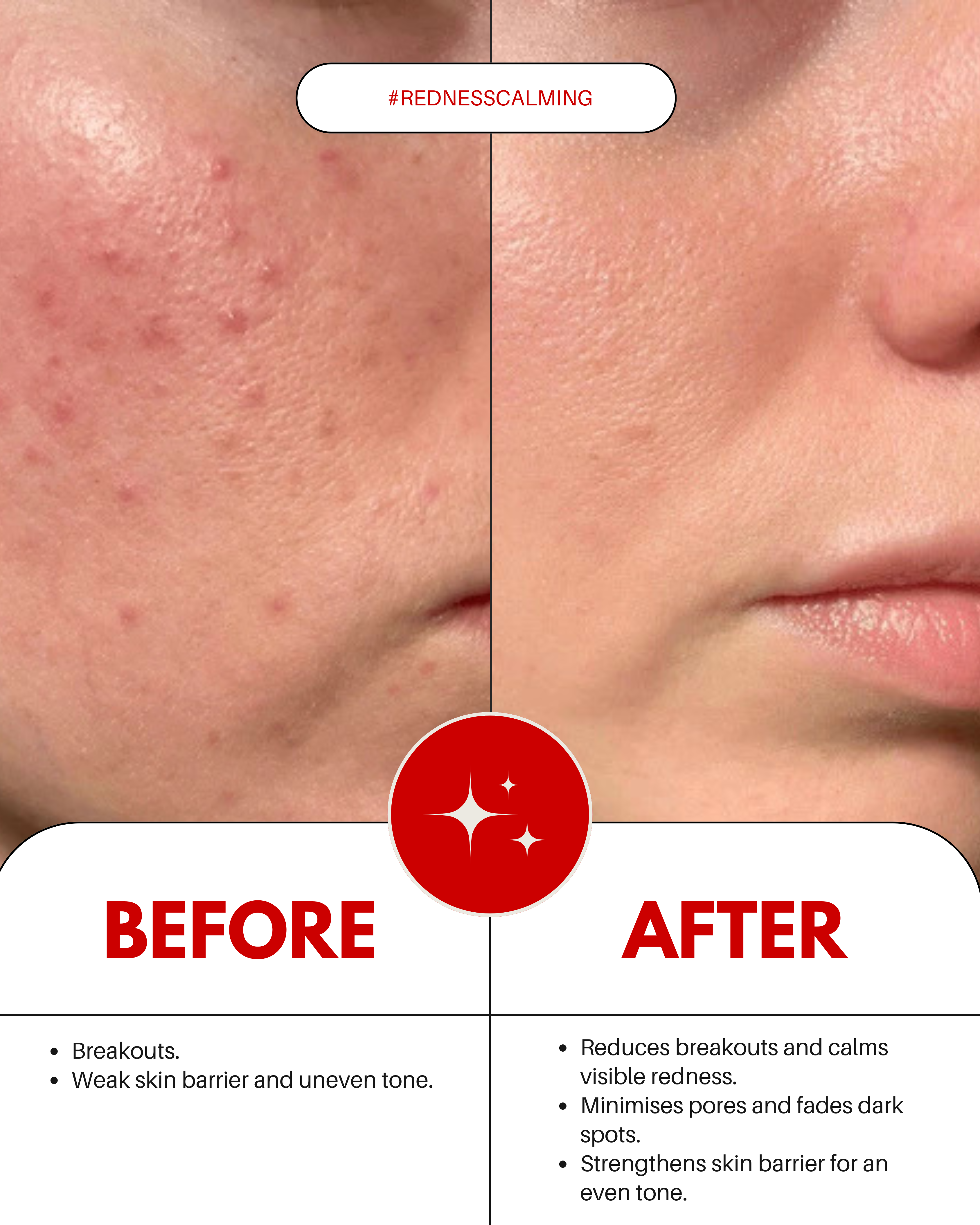 Redness Soothing Serum